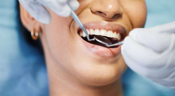 Best Chipped Tooth Repair Near Me  in Due West, SC