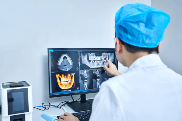 Emergency Dental Filling Replacement in SC